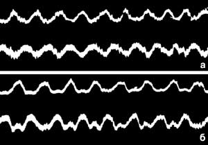 Рис. 16. Осциллограммы приложения усилий к педалям мастеров спорта СССР международного класса В. Нелюбина (а) и Ю. Дмитриева (б), во время движения по равнине 9,99Kb